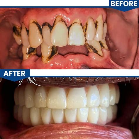 Smile Gallery | Central Valley Dentistry