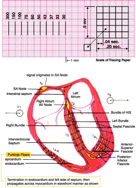 Image result for ECG Examples
