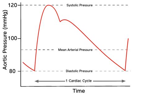Arterial Line Zero at Zane Bussell blog