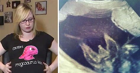 Exploding at Pregnancy 的图像结果