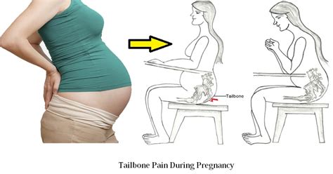 Tailbone Pain Early Pregnancy | Pregnancy Tips