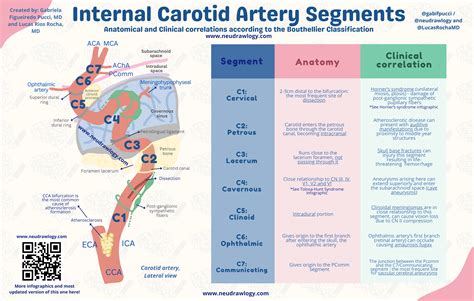 Vascular Neurology — Neudrawlogy: Simplifying Neurology