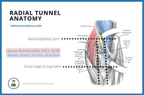 Posterior Interosseous Nerve