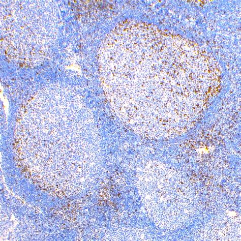 Tonsil Stained with Anti-CTLA4