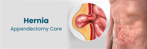 Hernia & Appendectomy Care in Karimnagar