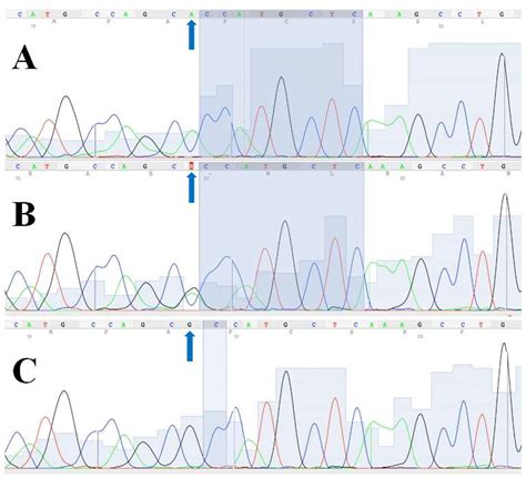 Genotypic and Allelic Distribution of the CD36 rs1761667 Polymorphism ...