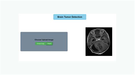 Image result for Brain Tumor Detection Using Machine Learning