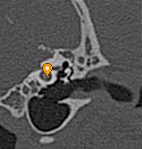 Modiolus - vet-Anatomy - IMAIOS