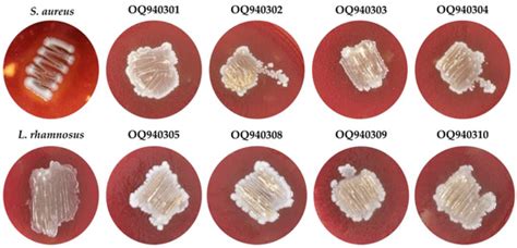 Isolation and Characterization of Enterococcus faecium from Fermented ...