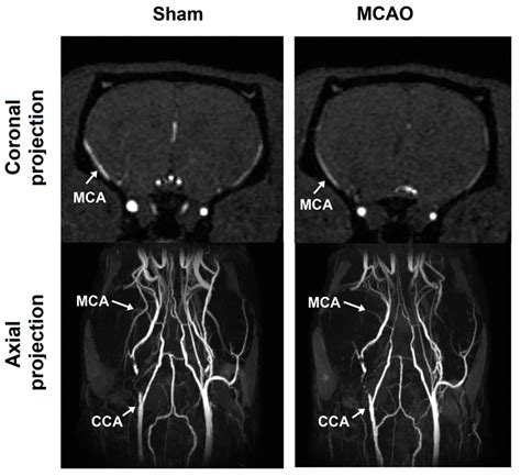 Tissue-Specific Ferritin- and GFP-Based Genetic Vectors Visualize ...