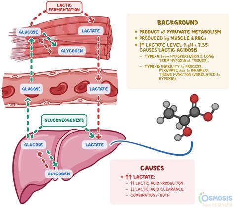 Understanding Lactate In Sepsis Using It To Our Advantage