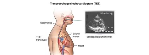 Image result for Tee Testing