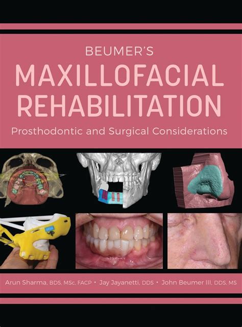 Buy Beumer's Maxillofacial Rehabilitation: Prosthodontics and Surgical ...