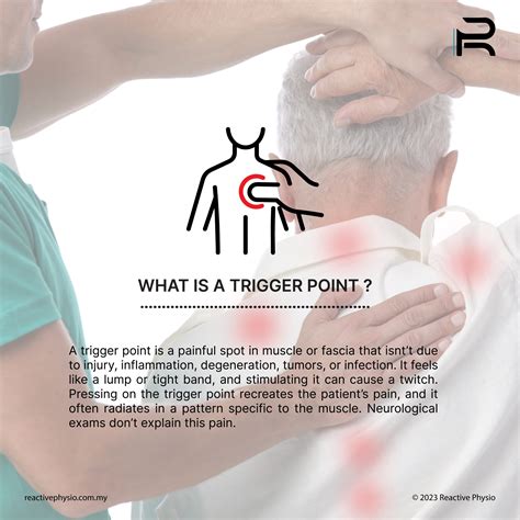 Exploring the Art of Healing: The Introduction of Dry Needling ...