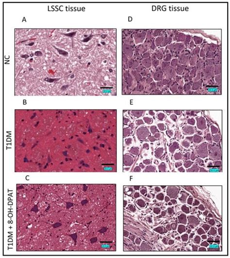 Activation of 5-HT1A Receptors Normalizes the Overexpression of ...