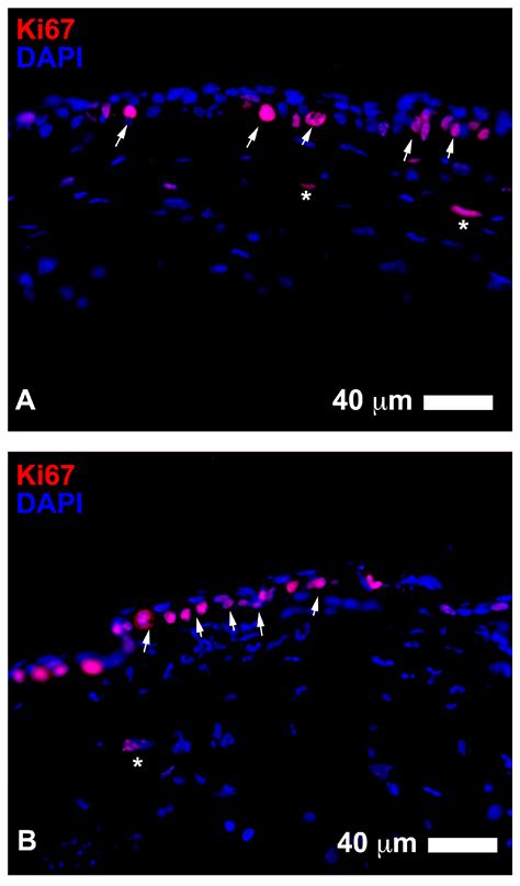Adipose Derived Stem Cells for Corneal Wound Healing after Laser ...