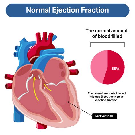 Ejection Fraction Use In Heart Failure at JENENGE blog