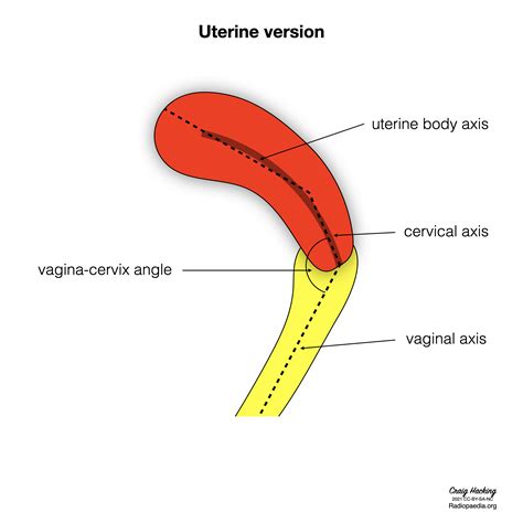 Uterus Doccheck Flexikon