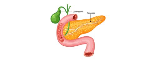 Pancreatic Cancer (Surgical Oncology) | Ailments - MGMCH, Jaipur