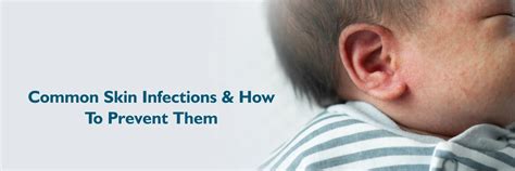 Common Skin Infections: Types and Prevention Tips