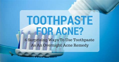 Image result for Toothpaste Causing Acne