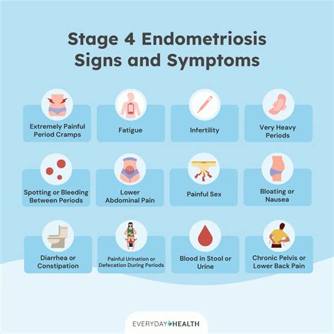 Stage 4 Endometriosis: Symptoms, Causes, Diagnosis, Treatment, and ...