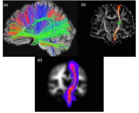 Can Musical Training Influence Brain Connectivity? Evidence from ...