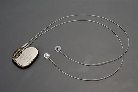 Detachable cardiac pacing lead may improve safety for cardiac patients ...