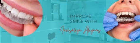 Best Professional Dental clinic in Hyderabad | Findent