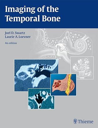 Imaging of the Temporal Bone eBook : Swartz, Joel D., Loevner, Laurie A ...