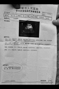 湖南42岁男子体检查出有子宫，医院回应：深感抱歉，记录员已经离职_报告单_先生_jpbl@jp