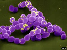 Image result for Enterococcus Faecalis Colon Cancer