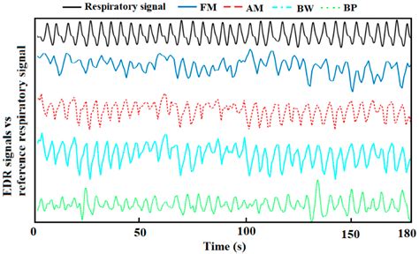 Estimation of the Respiratory Rate from Localised ECG at Different ...