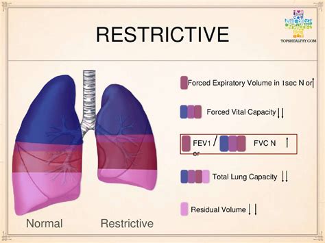 Restrictive Lung Disease and the ... Idiopathic Pulmonary Fibrosis ...
