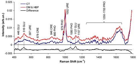 Biochemical Analysis of Urine Samples from Diabetic and Hypertensive ...