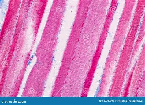 Image result for Skeletal Muscle Tissue Under Microscope