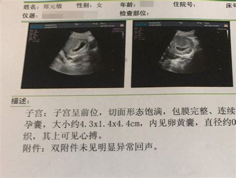 孕早期胚胎處於「危險期」，避免出現胎停育，孕媽要提前做好措施 - 壹讀