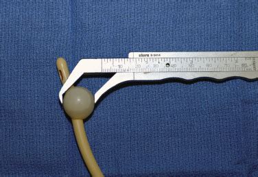 Image result for Patient Bad Example