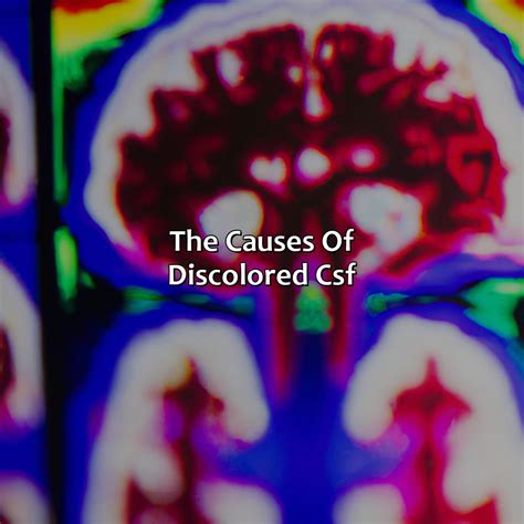 What Color Is Csf - colorscombo.com