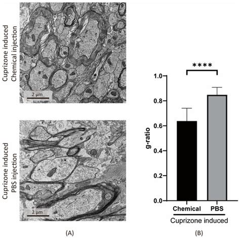 Development of a Chemical Cocktail That Rescues Mouse Brain ...