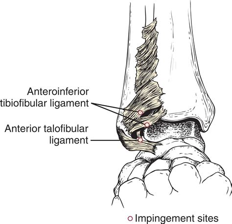 What Is Bassett S Ligament at Karen Moulton blog