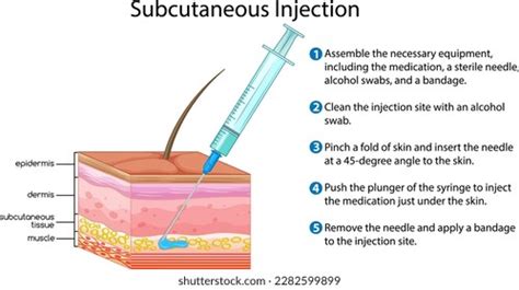 Deep Subcutaneous Injection 的图像结果