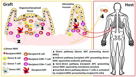 Intestinal Transplant Immunology and Intestinal Graft Rejection: From Basic Mechanisms to ...