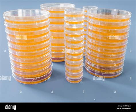 Agar plates. Stacks of Petri dishes with cultured agar Stock Photo - Alamy