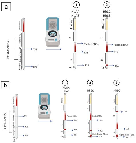 Techniques for the Detection of Sickle Cell Disease: A Review