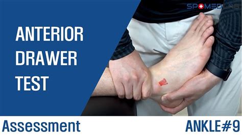 Anterior Drawer Test I 전거비인대(ATFL) 염좌 평가 I ankle#9 - YouTube