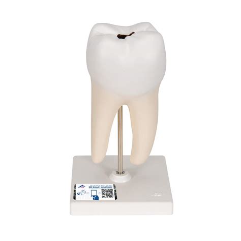 Buy 3B Scientific D10/4 Lower Twin-Root Molar Showing Cavities, 2 Part ...