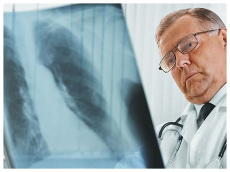 Tuberculosis: కొత్త క్యాన్సర్‌ థెరపీతో టీబీకి చెక్.. ఒక ట్రీట్‌మెంట్‌తో ...