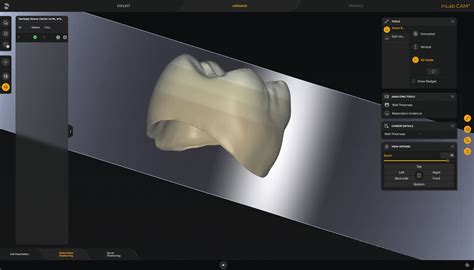 inLab MC X5: Dental Milling Machine | Dentsply Sirona India
