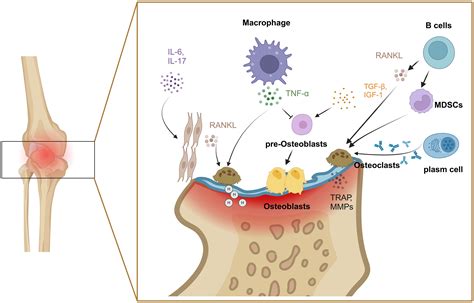 Rheumatoid Arthritis Diagram